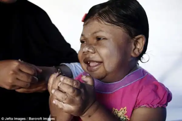 Meet 24-Year-Old Woman Who Looks Like 3-Year-Old Baby But She Menstruates (Photos)